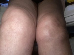 Lyndsay's knees!